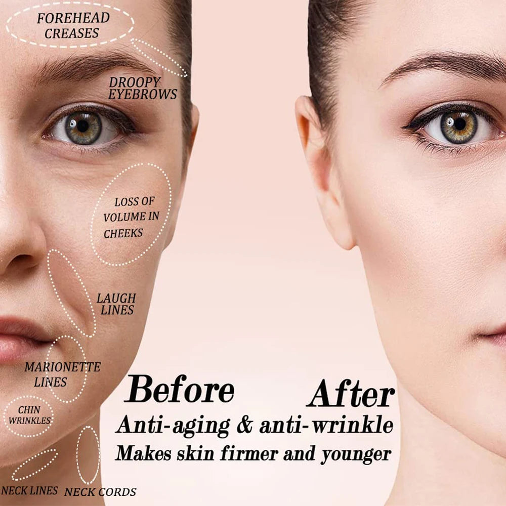 Silicone Cupping Massage Cups